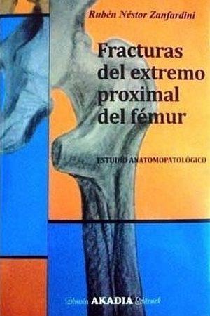 Fracturas del extremo proximal del femur